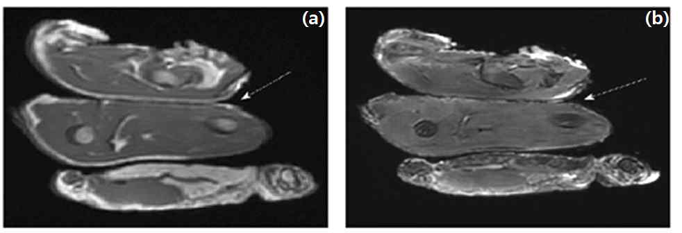 EBT2 필름을 닭 샘플에 넣어 촬영한 MR 영상 (a) T1 강조 영상, (b) T2 강조 영상