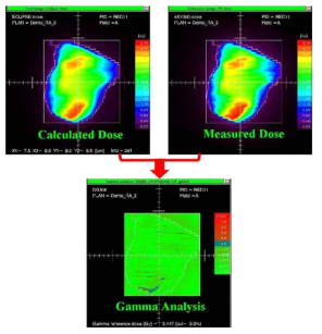 Gamma analysis 적용의 예