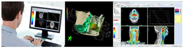 치료계획시스템(좌), 치료계획수립(중) 및 치료계획에 따른 환자 체 내 방사선량 분포 계산 결과(우)