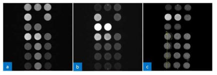 T1/T2 turbo spine echo (TSE) sequence images and CT image of silicone oil mixed chemical compounds: (a) T1 TSE, (b) T2 TSE and (c) CT