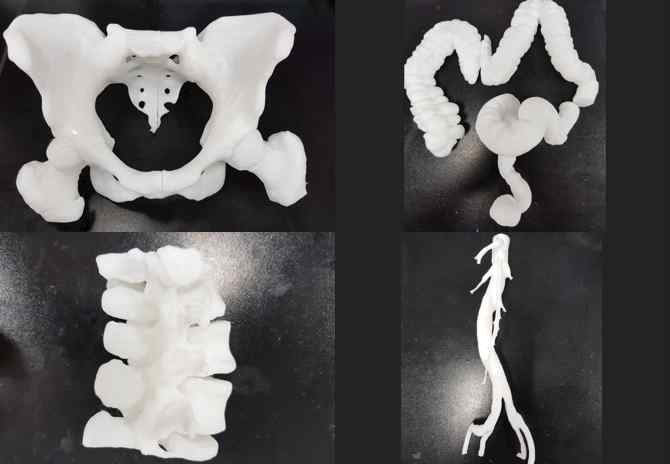 3D 프린터로 출력한 장기 모형