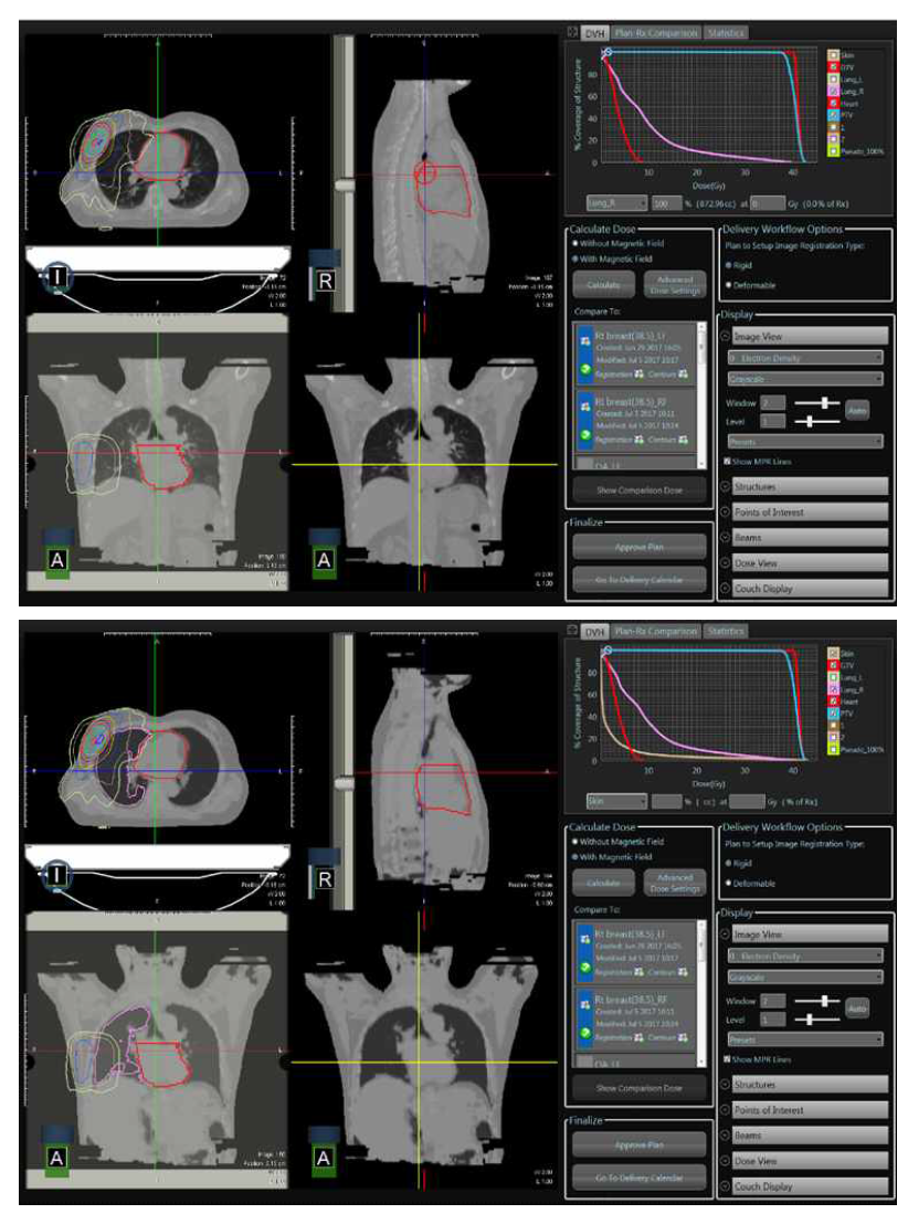 기존 CT 영상(위)과 딥러닝 기반 합성 CT 영상(아래)에 기반한 환자치 료계획 및 방사선량 분포 계산 결과