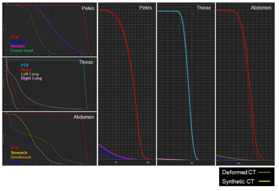 골반부, 흉부, 복부 부위별 변형CT와 합성CT를 사용한 치료계획에서의 선량체적히스토그램 비교