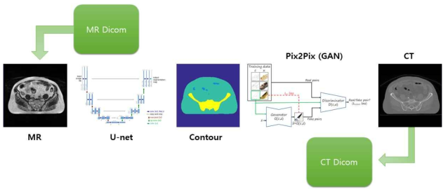 Contour를 이용한 합성 CT 생성 모델 개요