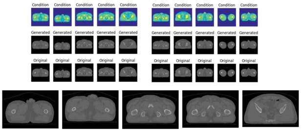 Prostate Contour 영상으로부터 pix2pix 모델을 거쳐 CT영상을 생성해낸 결과