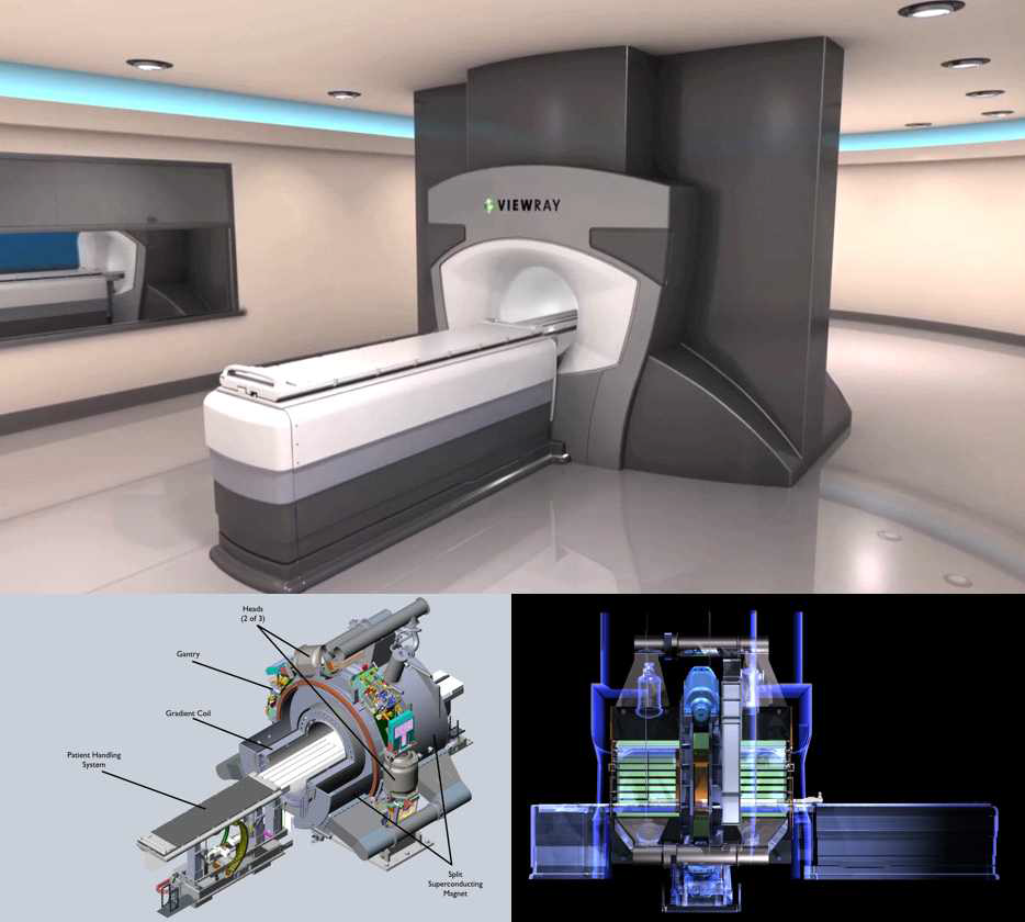 뷰레이 시스템(ViewRay system, ViewRay Inc., Cleveland, OH, USA)