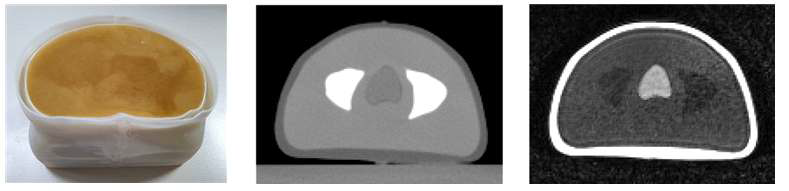 제작된 골반 팬텀 사진(좌)과 CT(중) 및 MR(우) 시스템으로 촬영한 영상