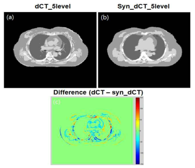 본 연구를 통해 획득한 합성CT와 MR영상을 이용하여 획득한 CT의 axial 영상과 차이