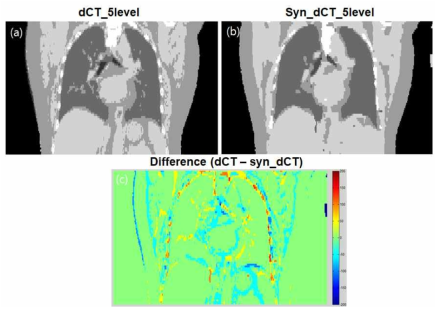 본 연구를 통해 획득한 합성 CT와 MR영상을 이용하여 획득한 CT의 coronal 영상과 차이