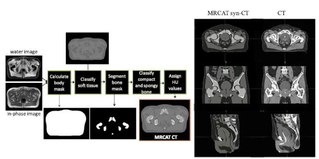 MRCAT 합성CT 생성 개념도(좌) 및 합성CT 및 원 CT 비교 (우)