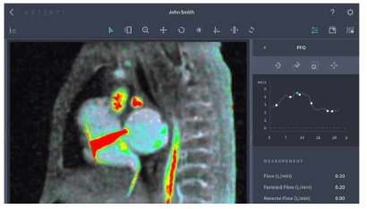 심장혈류를 시각화하는 아터리스의 4D Flow
