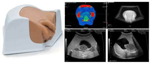 CIRS 사의 Multi Modality Pelvic Phantom (048A) 및 CT, 초음파 영상