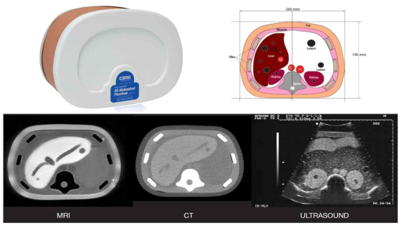 CIRS 사의 Triple Modality 3D Abdominal Phantom (057A) 및 MR, CT, 초음파 영상