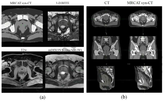 Neelam Tyagi et al. (a) 합성CT와 합성CT 생성을 위하여 이용한 MR 시퀀스, (b) 실제 CT보다 우수한 합성CT의 연부조직 대조도