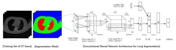폐CT 영상에서 딥러닝 기술을 적용한 세그먼테이션