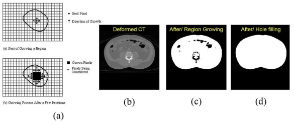 변형된 CT 영상에서 환자의 신체영역만을 추출하기 위한 과정. (a) 3차원 영역성장법, (b) 3차원 CT 영상, (c) 영역성장법으로 분할한 문턱값 이내의 신체영역, (d) 전체 신체영역