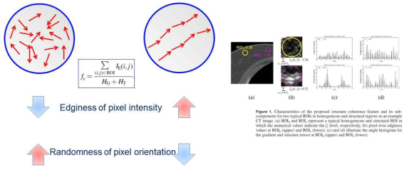 CT 영상에서 잡음과 아티팩트의 영향이 적은 화소를 구조물일관도 특성값을 이용하여 추출해 냄