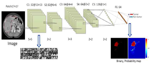 CNN을 이용한 간 CT에서 간종양 분할 방법 (W. Li et. al. 2015)