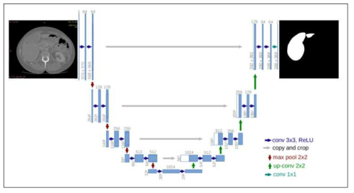 알고리즘에 사용된 딥러닝 기반의 U-net 구조