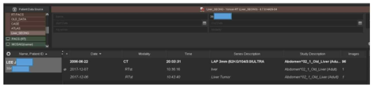 MIM 소프트웨어 안에 한 환자를 선택하게 되면 해당 환자의 CT와 간정상조직을 그린 DICOM RTstructure “Liver”와 암 조직을 도식한 “Liver Tumor”의 RTstructure가 저장이 되어있음