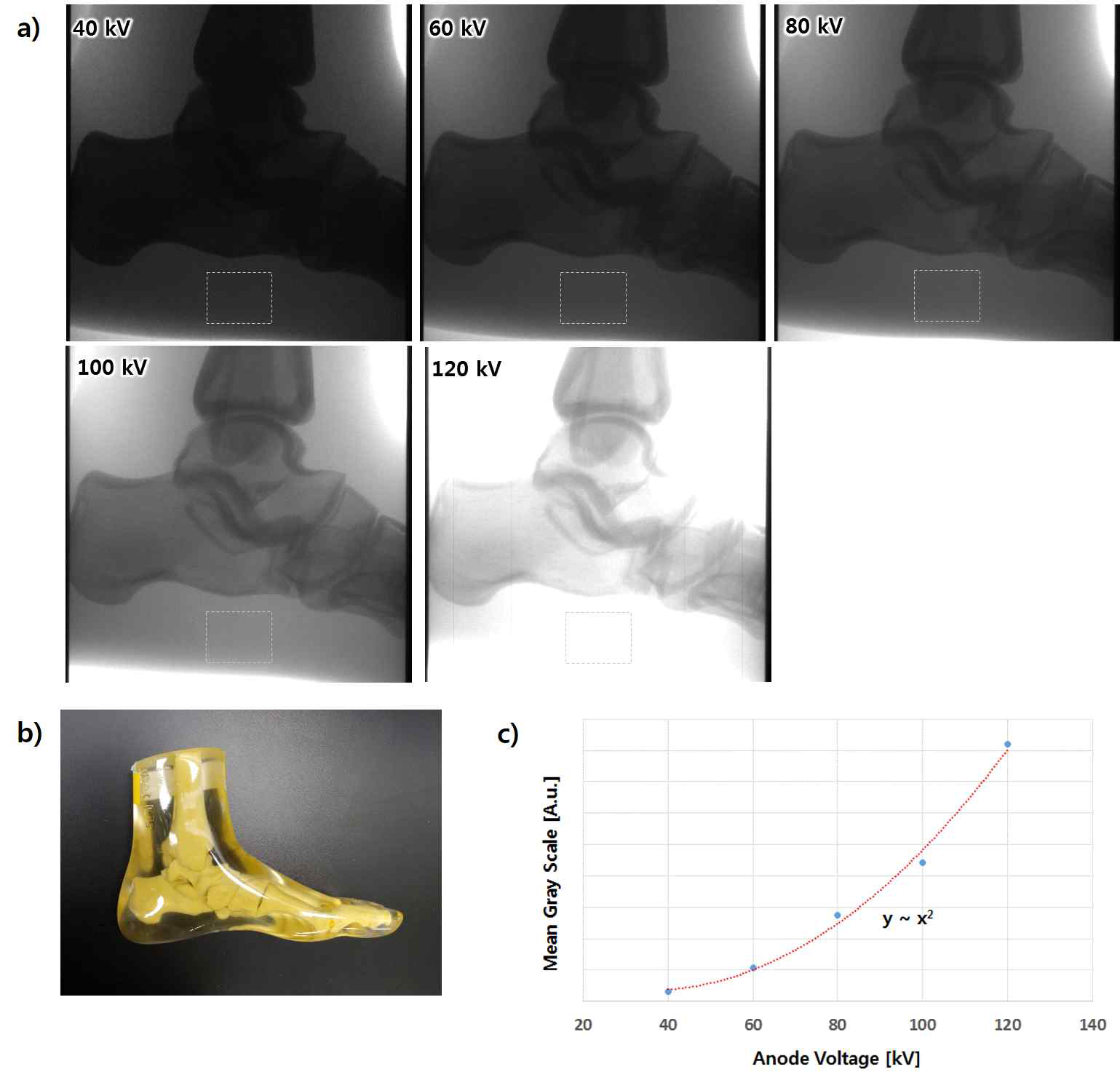 a) 디지털 엑스선 튜브로 촬영한 관전압에 따른 엑스선 영상 b) 피사체로 사용된 인체 발목 모형 팬텀 c) 관전압에 따른 점선 사각형 내의 평균 그레이스케일(gray scale) 변화