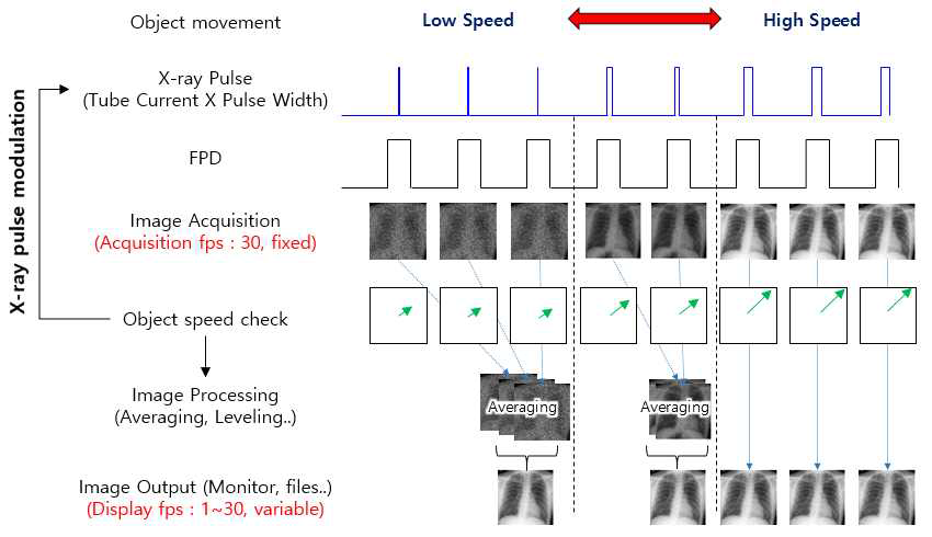 적응가변선량율(AVD, Adaptively Variable Dose-rate) 투시 영상 시스템 개념