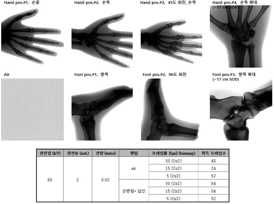 딥러닝을 이용한 노이즈 저감 기술 개발 용 엑스선 영상 데이터