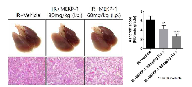 MEKP-1 투여 농도에 따른 방사선 폐손상 억제 효과