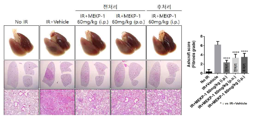 MEKP-1 투여 시기 및 경로에 따른 방사선 폐손상 억제 효과