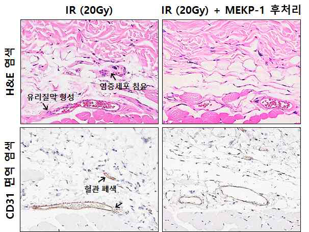 MEKP-1 후처리에 따른 방사선 피부 손상 억제 효과