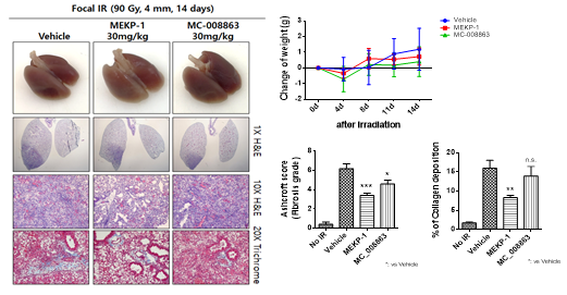 MEKP-1 유도체 복강 내 투여에 따른 방사선 폐손상 억제 효과 (Ⅰ)