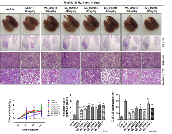 MEKP-1 유도체 복강 내 투여에 따른 방사선 폐손상 억제 효과 (Ⅱ)