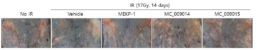 MEKP-1 유도체 투여에 따른 방사선 유도 피부 손상 억제 효과 (Ⅱ)