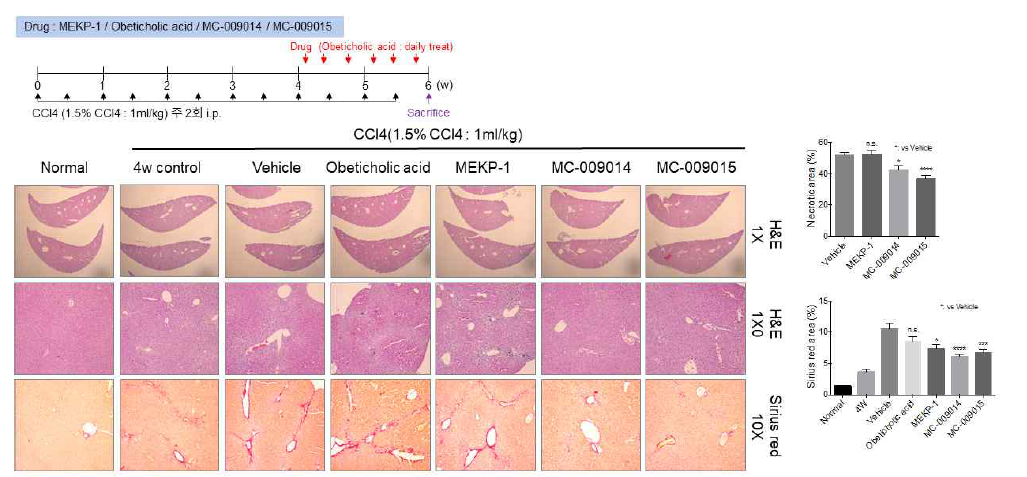 MEKP-1 유도체 경구 투여에 따른 비알콜성 간 손상 억제 효과 확인 (Ⅱ)