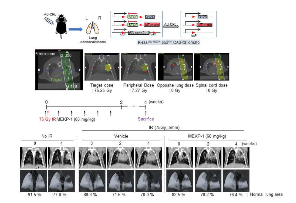 단일 종양 결절 비소세포성 폐암 모델 시스템 및 표적 방사선 조사 이미지 유도 시스템