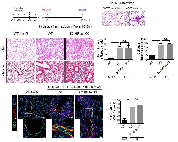 혈관내피세포 Endogenous HIF1⍺ 발현 조절에 따른 방사선 폐섬유화