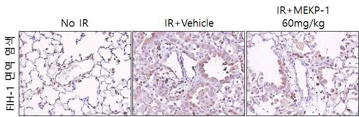 방사선 폐손상시 FIH-1 발현의 변화