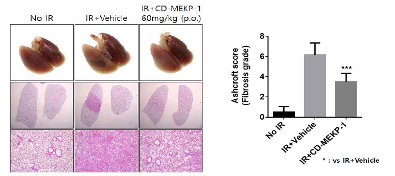CD-MEKP-1의 방사선 폐손상 억제 효과