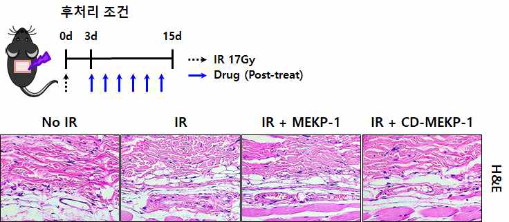 MEKP-1 및 CD-MEKP-1 후처리에 따른 방사선 피부손상 보호 효과