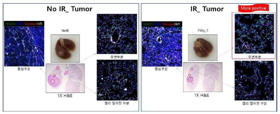폐암 마우스 모델에서 방사선 유도 하이폭시아 부위의 NQO1 발현