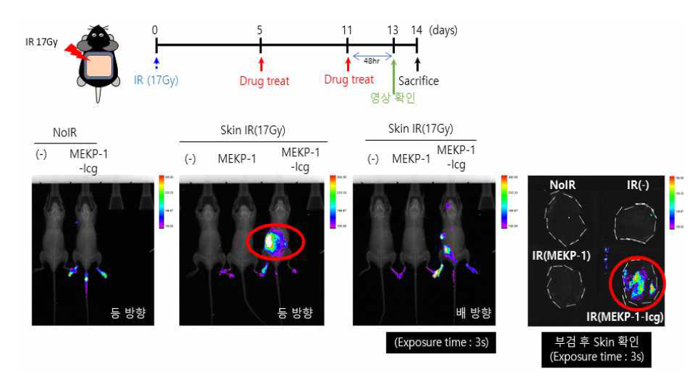 방사선에 의한 Skin 손상에서 MEKP-1-Icg trace