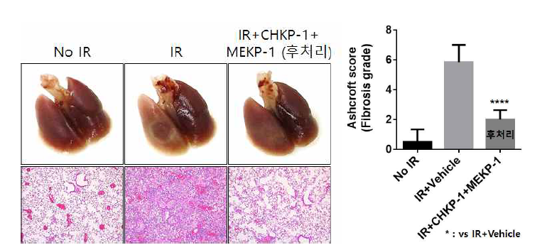 MEKP-1과 CHKP-1 후처리 혼합 투여에 따른 방사선 폐손상 억제 효과