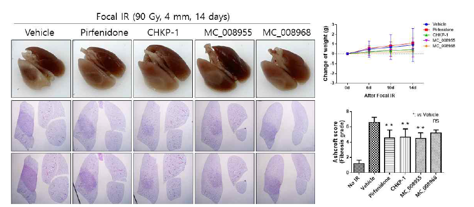 CHKP-1 유도체 투여에 따른 방사선 유도 폐손상 및 폐 섬유화 억제 효과