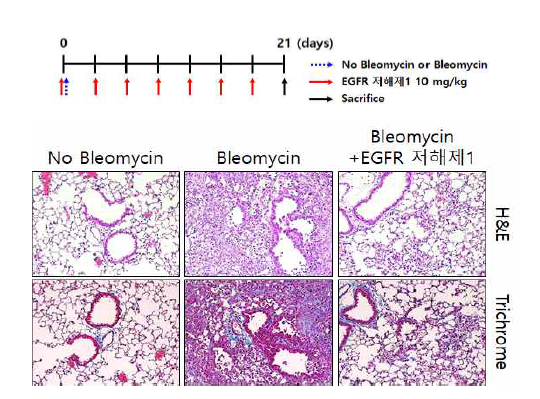 EGFR 저해제1 투여에 따른 블레오마이신 유도 폐손상 및 염증 억제 효과
