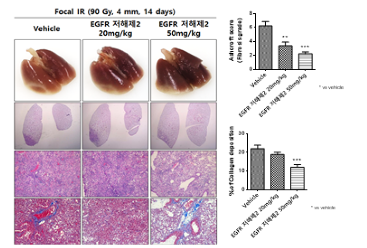EGFR 저해제2 투여 농도에 따른 방사선 폐손상 억제 효과