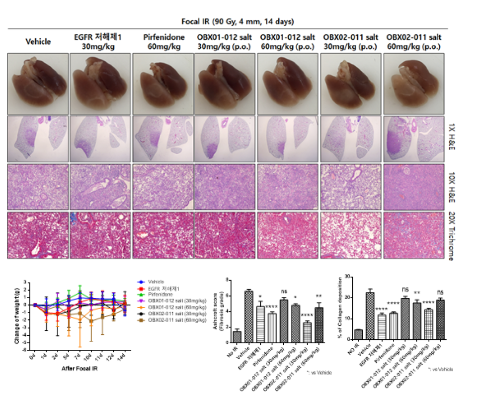 물성 개선된 EGFR 저해제 경구 투여에 따른 방사선 폐손상 억제 효과