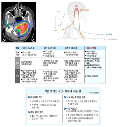 입자선 치료의 특성 및 비교 이해도