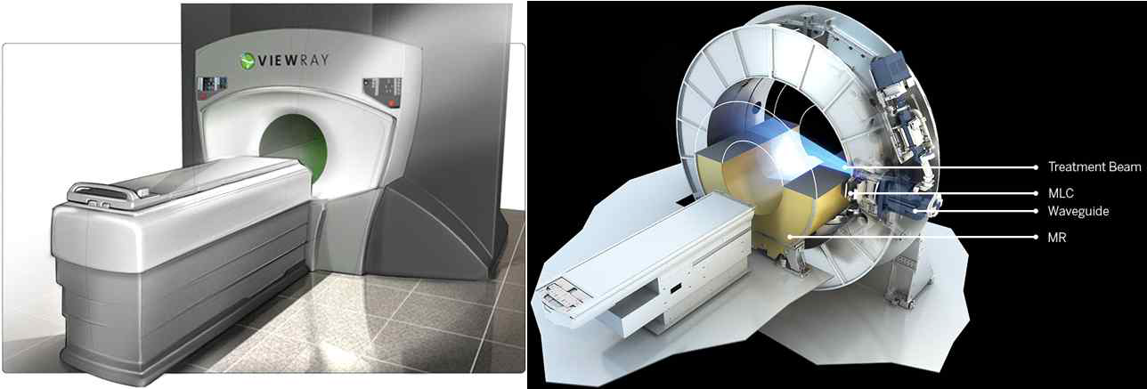 첨단 MR영상유도 방사선치료기기, ViewRay system (좌) 및 Elekta 사에서 개발 중인 MR영상유도 방사선치료기기(우)