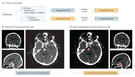 두경부 CTA (Computed Tomography Angiogram) 사진을 활용한 deep learning-assisted 뇌동맥류 진단 시스템 framework
