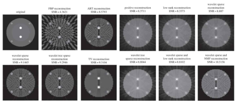Sparse sampling에서의 다양한 재구성 알고리즘의 영상화질 비교